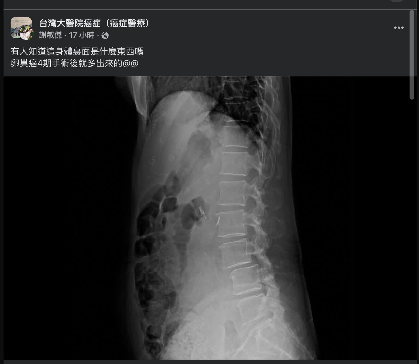 原始貼文配圖:病人拿 AI 問醫師:工具、懷疑與診間信任